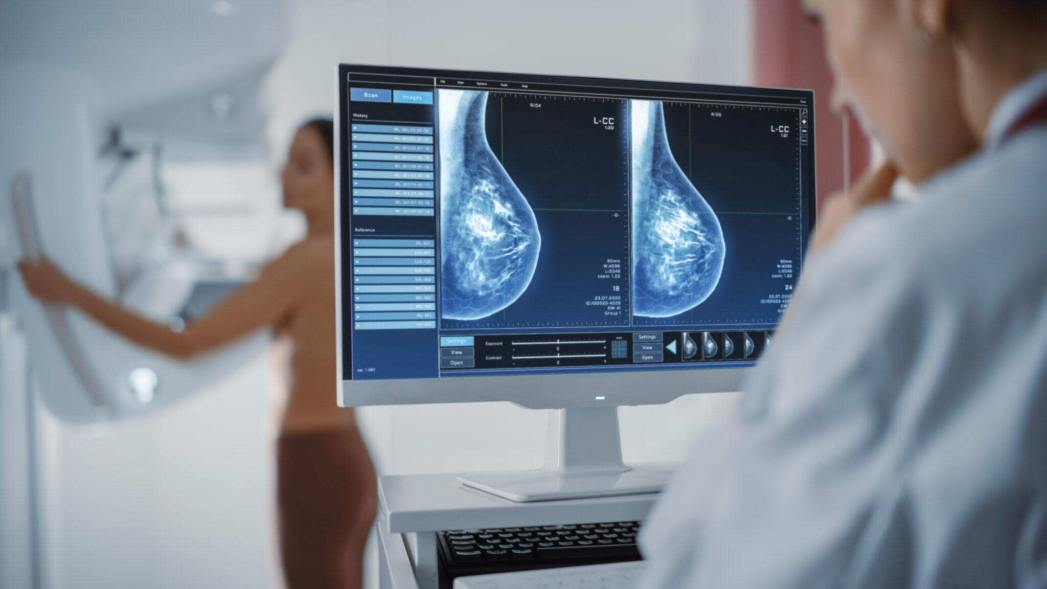 Mummogram Diagnostic Mammogram: Demystifying Additional Imaging | Windsong